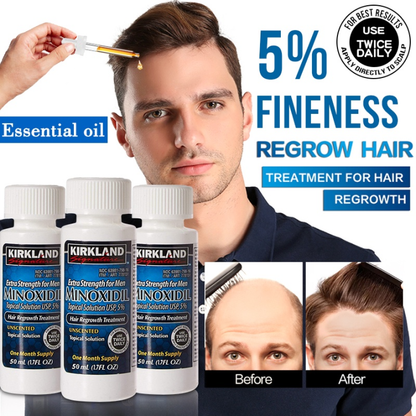 Minoxidil 5% Kirkland